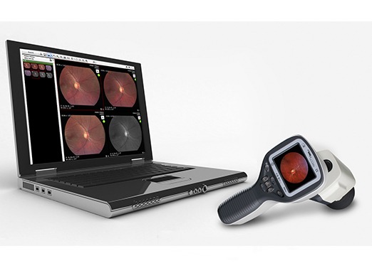 Volk Pictor Plus portable ophthalmic retinal camera