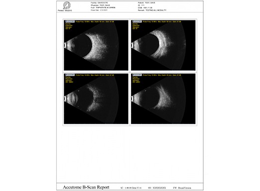 Accutome 4Sight - A-Scan and B-Scan Probes