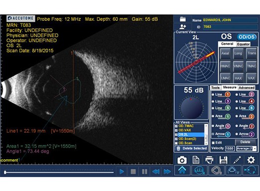 Accutome 4Sight - B-Scan Probe