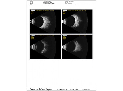 Accutome 4Sight - B-Scan Probe