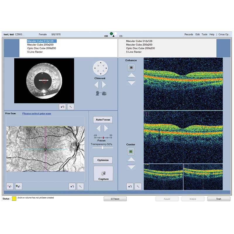 CIRRUS HD-OCT 5000/500 Advancing Smart OCT