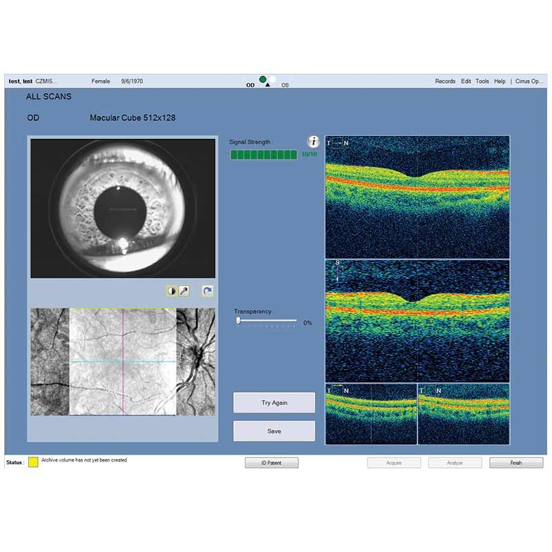 CIRRUS HD-OCT 5000/500 Advancing Smart OCT