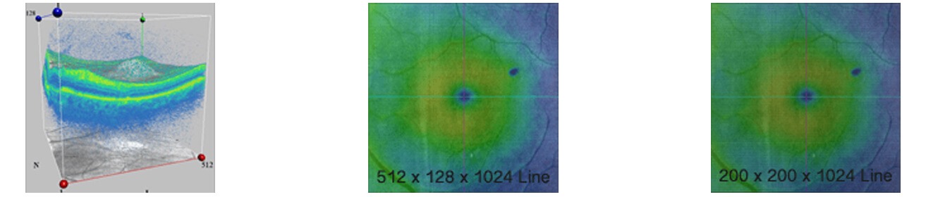 CIRRUS HD-OCT 5000/500 Advancing Smart OCT