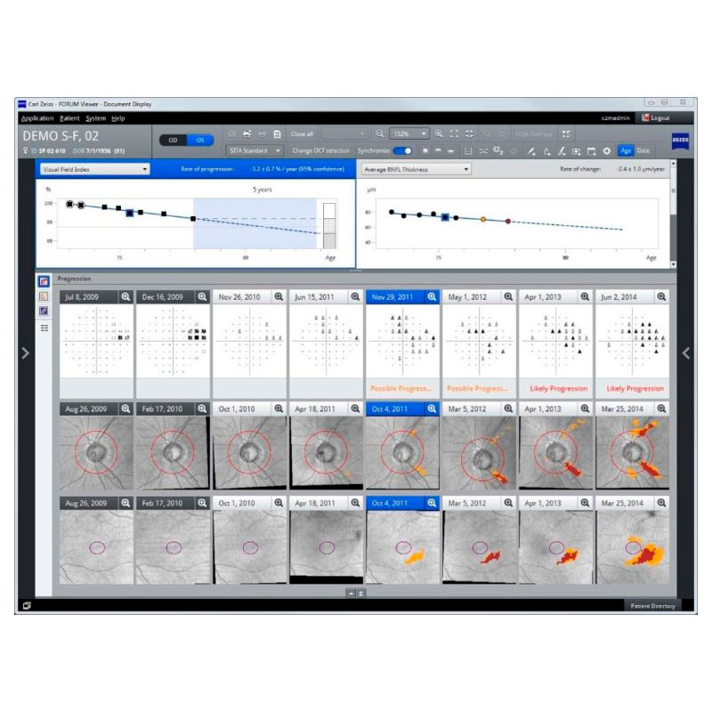 Reduce testing time. Increase insight into glaucoma. ZEISS Humphrey Field Analyzer 3