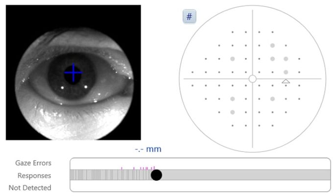 Reduce testing time. Increase insight into glaucoma. ZEISS Humphrey Field Analyzer 3