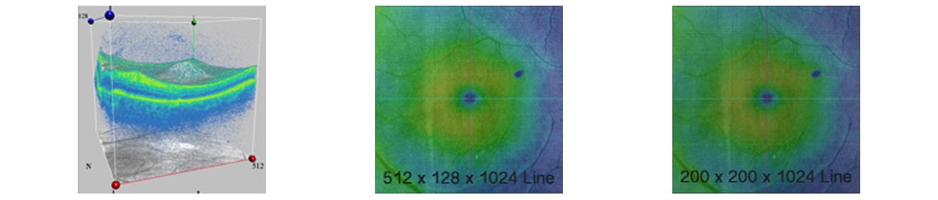 CIRRUS HD-OCT 5000/500 Advancing Smart OCT