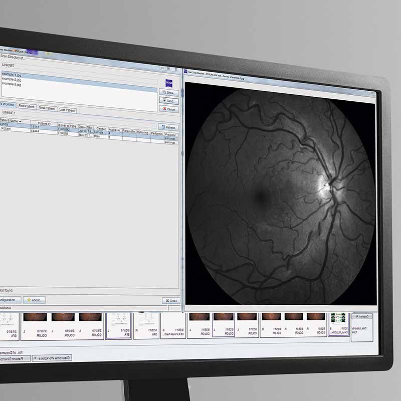 ZEISS Data Management. Scalable ophthalmology software