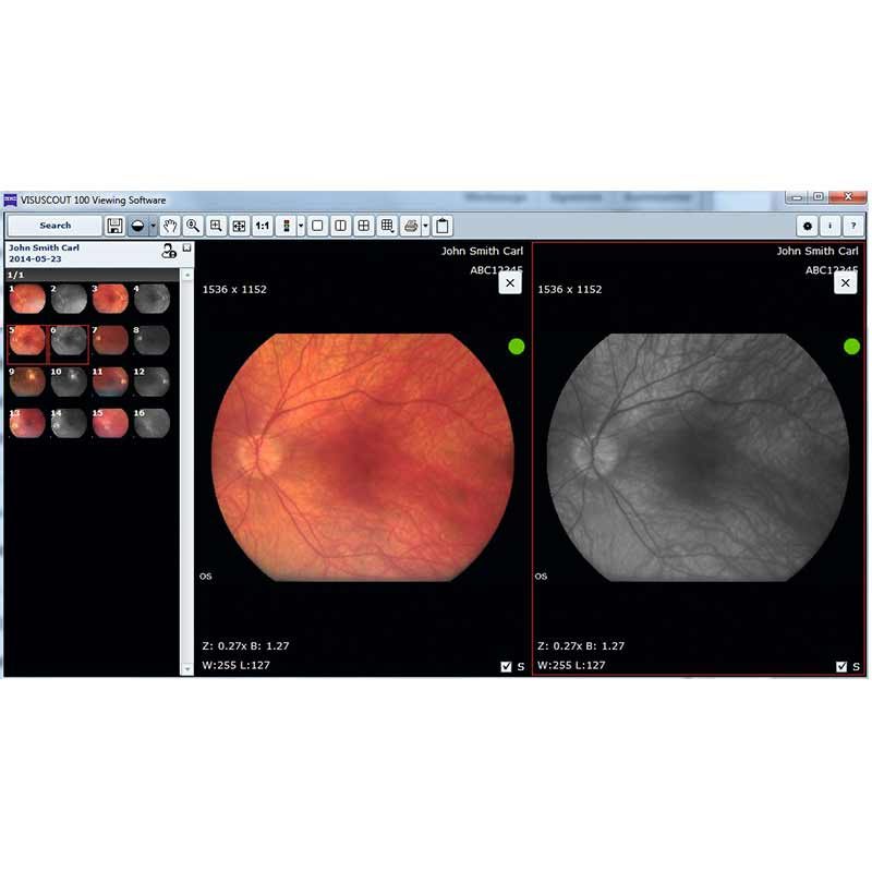 ZEISS VISUSCOUT 100. Handheld fundus camera