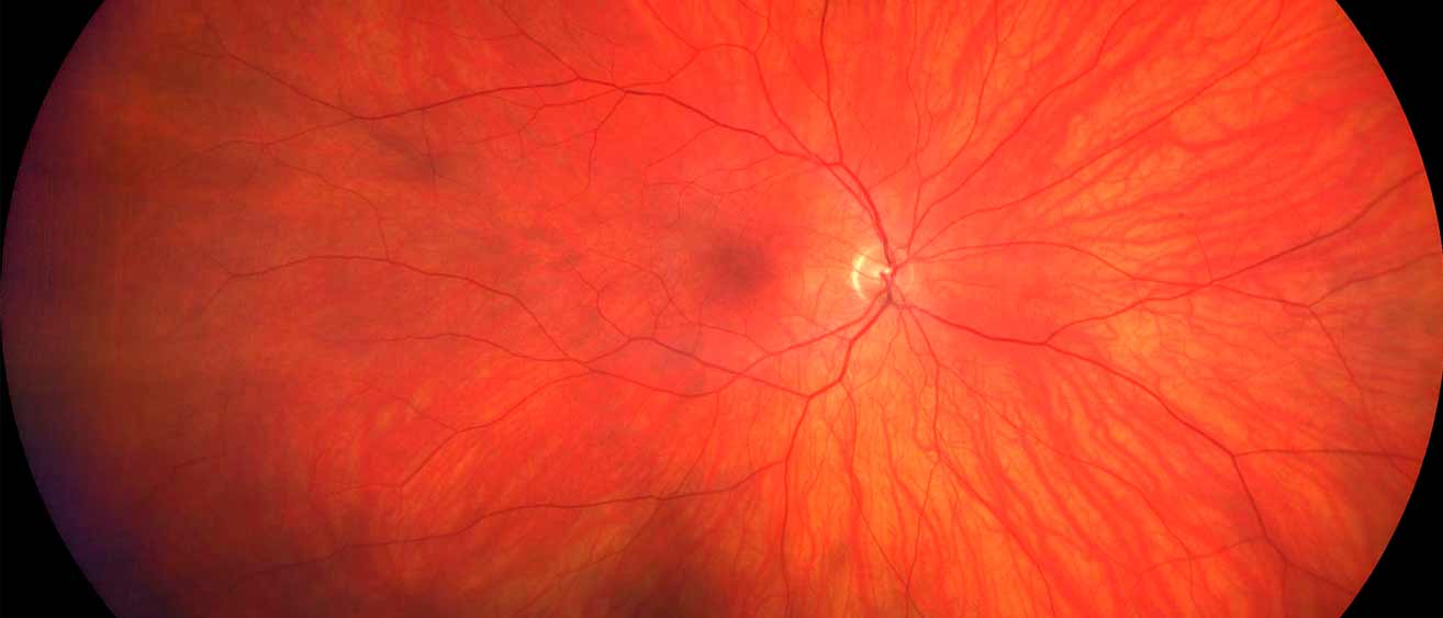 ZEISS CLARUS 500. Imaging ultra-wide without compromise.